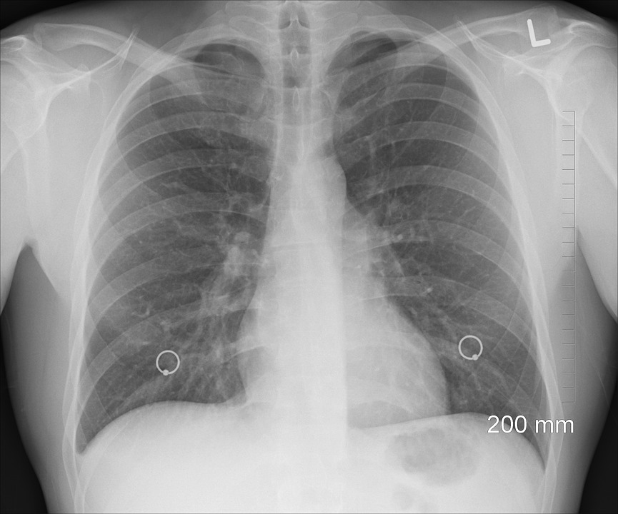 Asthma not a hindrance