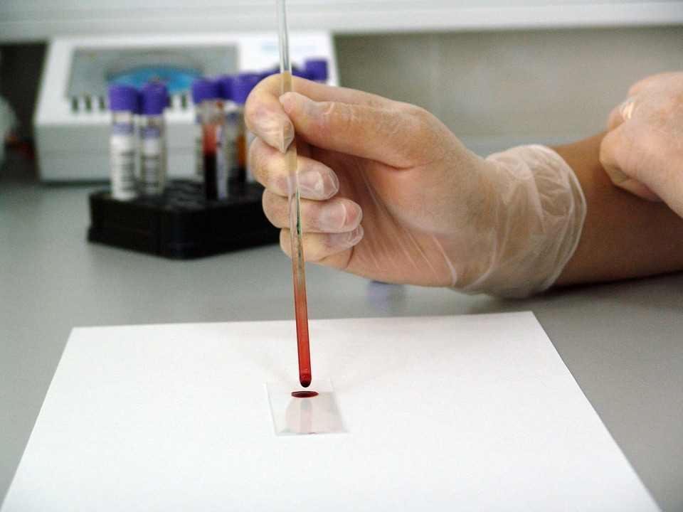 Different Types of Allergy Testing Different Types of Allergy Testing